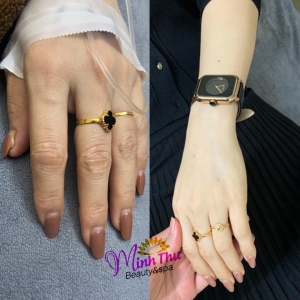 Truyền trắng là gì?